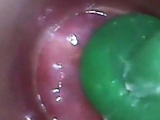  Tube Cock Endoscope Pov Urethral Insertion Ball Rod...