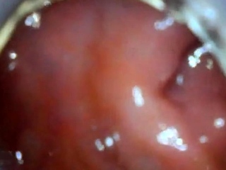 Anal Endoscope Ass Play From Inside...